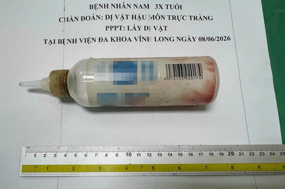 Bác sĩ phẫu thuật gắp chai nhựa mắc kẹt trong trực tràng nam bệnh nhân