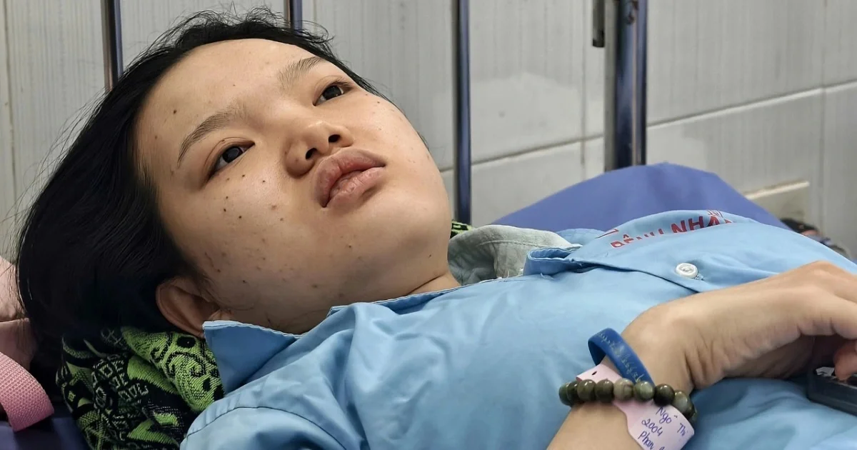 Khoảnh khắc sinh tồn của nữ sinh trong vụ hỏa hoạn xe khách làm 7 người thiệt mạng tại Đồng Nai